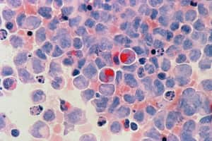 cell cancer cell