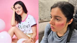 Divya injured