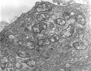 Scrub Typhus Orientia tsutsugamushi