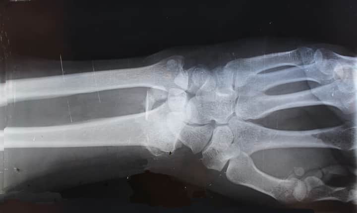 X-ray Bengali News