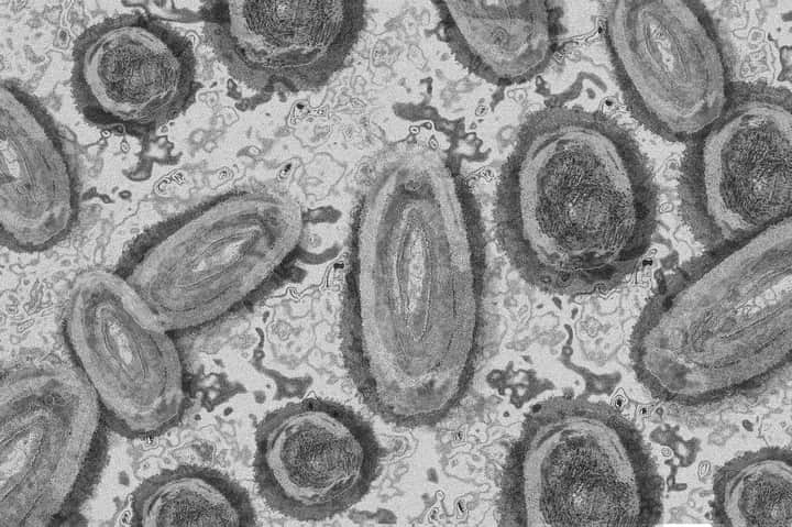 Monkey pox | Bengali News